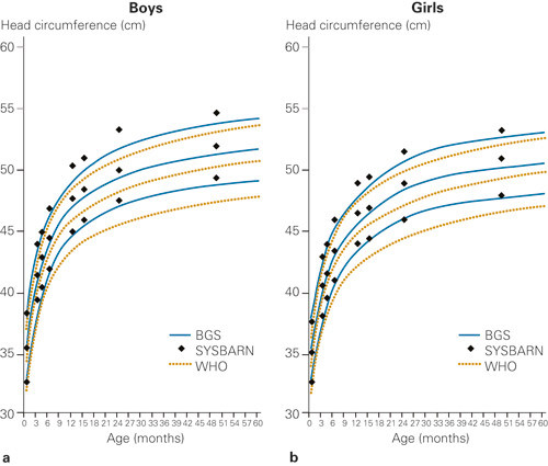 Figure 3 Comparison between head circumference-for-age from new Norwegian growth charts (based on the Bergen Growth Study)…