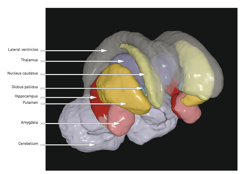 Fig. 2 Three-dimensional illustration of subcortical structures based on a template from the MRI post-processing tool…