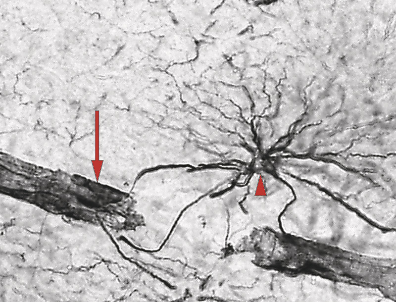 Figure 2 Astrocyte extending processes towards the brain parenchyma and blood vessels. Immunohistochemical visualisation of…