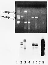 Figur 1    Øverst) Etidiumbromidfarget gel ved PCR-undersøkelse for t(14;18). Brønn 1 størrelsesmarkør (ikke DIG-merket);…