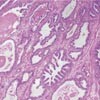 Figur 1    Et sammensatt (kompositt) bilde av prostatakjertel bestående av 81 (9 ⋅ 9) synsfelt, med 1024 ⋅ 1024 piksler…