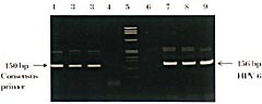 Figur 9    PCR fra pasient 4 for påvisning av humant papilloma-virus (HPV) med konsensusprimere Gp5+/6+ og typespesifikke…