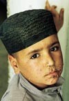 Gutt med impetigo. Alle vanlige &laquo;norske&raquo; barnesykdommer finnes i Afghanistan. Hudsykdommer, diar&eacute;, luftveissykdommer og&hellip;