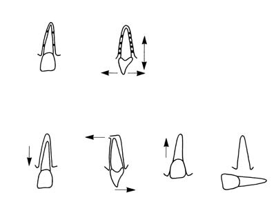 Figur 3  Klassifikasjon av skader i tannens støttevev (periodontiet) som benyttes ved Avdeling for pedodonti og atferdsfag,…