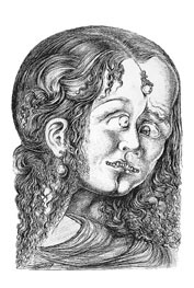  Figur 4    Salvador Dalî: Macbeth. Dalî har her grepet til en fremstilling som sees hos enkelte schizofrene, nemlig en…