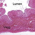  Figur 1    Lysmikroskopisk bilde av formalinfiksert, parafininnst&oslash;pt, hematoksylin-eosinfarget vevssnitt fra eggledervegg&hellip;