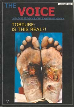 Alvorlige fotskader hos kenyaneren Chacole Olo etter at han ble torturert i tre dager av politiet og storvilttilsynet…