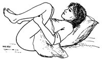 Figur 3  McRoberts manøver utføres med maksimal fleksjon i hofte og kneledd. Illustrasjon Ellinor M. Hoff
