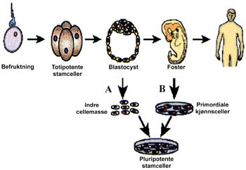 Figur 1   To metoder for fremstilling av pluripotente stamceller. A fra overtallige befruktede egg (blastocyst) (Thomsen…