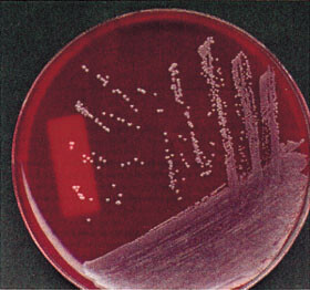 Blodagarskål med bakteriekolonier av Staphylococcus aureus. Foto S. Holta Ringertz, Aker sykehus