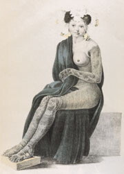 Figur 9   Ichtyose 1830 (12). Foto Universitetsbiblioteket, Oslo