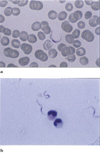 Figur 3   a) En trypanosom mellom erytrocytter i tynn dråpe (blodutstryk). b) Tre trypanosomer (og to granulocytter) i tykk…