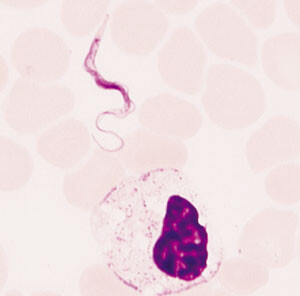 Figur 1   Trypanosomparasitt med granulocytt. Blodutstryk fra en pasient med trypanosomiasis brucei rhodesiense. Foto J.O…