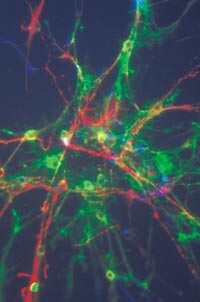 Stamceller i menneskehjernen: nerveceller fremstår som røde, astrocytter som blå og oligodendrocytter som grønne. Foto Neuro…