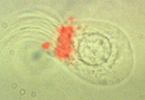 En enkelt ependymalcelle fra en av hjernens ventrikler. Denne celletypen er sentralnervesystemets egen stamcelle. Foto Neuro…