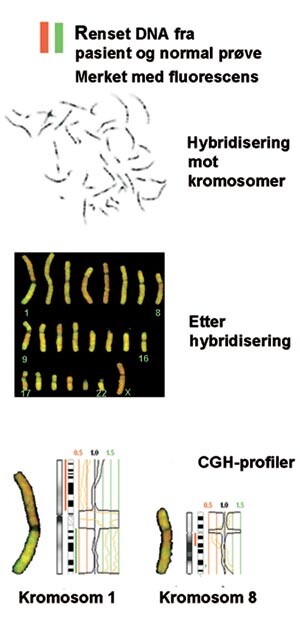 Figur 4  Skjematisk illustrasjon av prinsippet for komparativ genomisk hybridisering (CGH). Metoden viser tap eller…