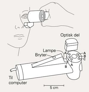 Eit infraraudt elektronisk pupillometer. Den optiske delen vert halden mot kinnbeinet. A og B indikerer plasseringa av…