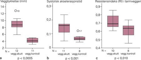 Veggtykkelse (a), systolisk akselerasjonstid (b) og resistensindeks (c) i colon ved akutt iskemisk kolitt. Diagrammene viser…