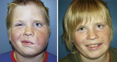 Olav i 2002 og i 2004. Begge foto Lars Salemark