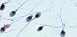 Verdens helseorganisasjon har gitt strenge retningslinjer om testing av s&aelig;d. Foto Andrologisk laboratorium/Rikshospitalet