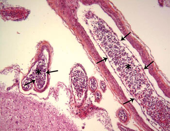 Figur 1  Meningeale blodkar hvor lumina (pil) er fylt av lymfoide celler (stjerne). Hematoksylin-eosin x 20. Foto…