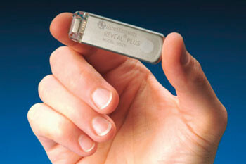 Figur 1 Reveal Plus (Medtronic Inc.). Langtids rytmeovervåker som implanteres subkutant over venstre pectoralismuskel,…