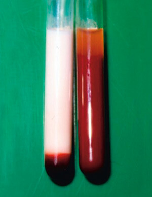 Figur 3  Blakket serum. Foto Knut Nordstoga, Norges veterinærhøgskole