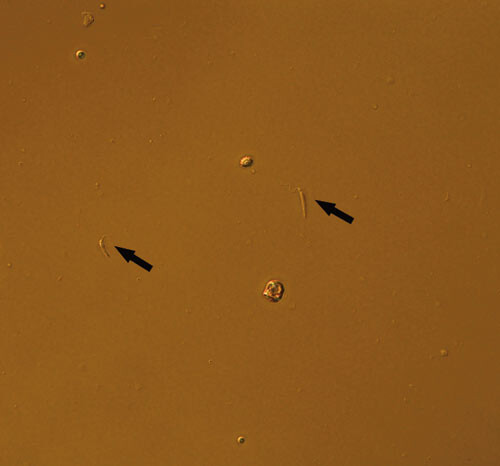 Figur 2  Kultur fra beinmargsaspirat (våtpreparat, x 400): 8 – 10 µm store stavformede leishmaniapromastigoter med flagell