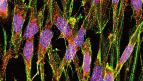 Fluoresceinfargede gliaceller. Tau-protein er her farget rødt og rosa. Avleiringer av tau-protein kan ses ved enkelte…