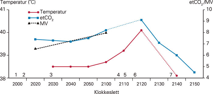 Figur 1 Verdier for temperatur, endetidal CO₂ (etCO₂) og minuttventilasjon (MV) registrert under oppholdet på…