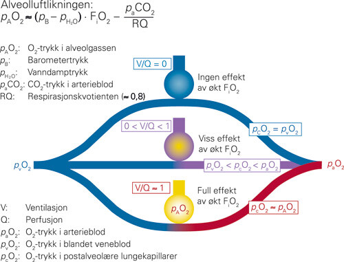 Figur 1 Alveolluft og lungeshunt. Alveolluftens oksygentrykk, pAO₂, bestemmes av barometertrykk, trykket av CO₂ i alveolene…