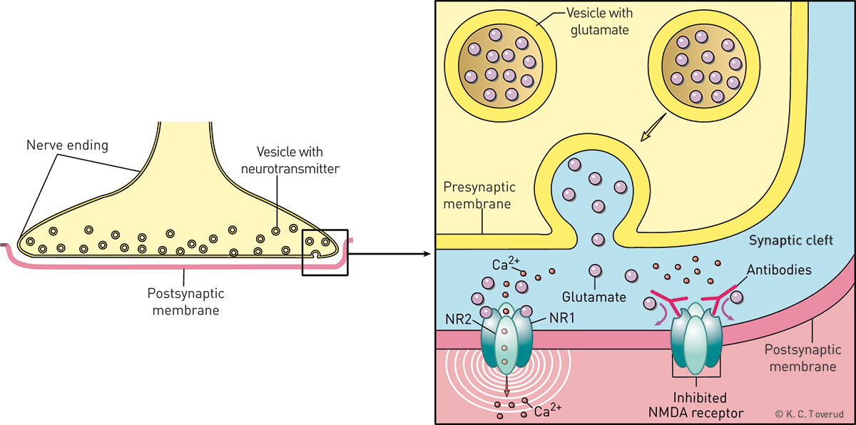 Figure 3  Schematic illustration of NMDA (N-methyl D-aspartate) type glutamate receptors in the brain. The NMDA receptor…