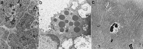 Figur 1  Forandringer i eksokrine pancreasceller hos en 56 dager gammel hyperlipemisk mink som var klinisk frisk og uten…
