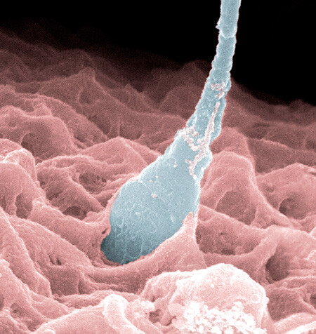 Illustrasjonsfoto Science Photo Library/NTB Scanpix