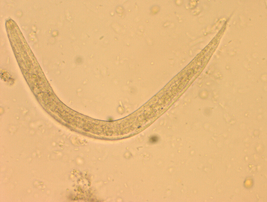 Figur 1Strongyloides stercoralis i avføringsprøven. Foto: Avdeling for mikrobiologi og smittevern, Akershus…
