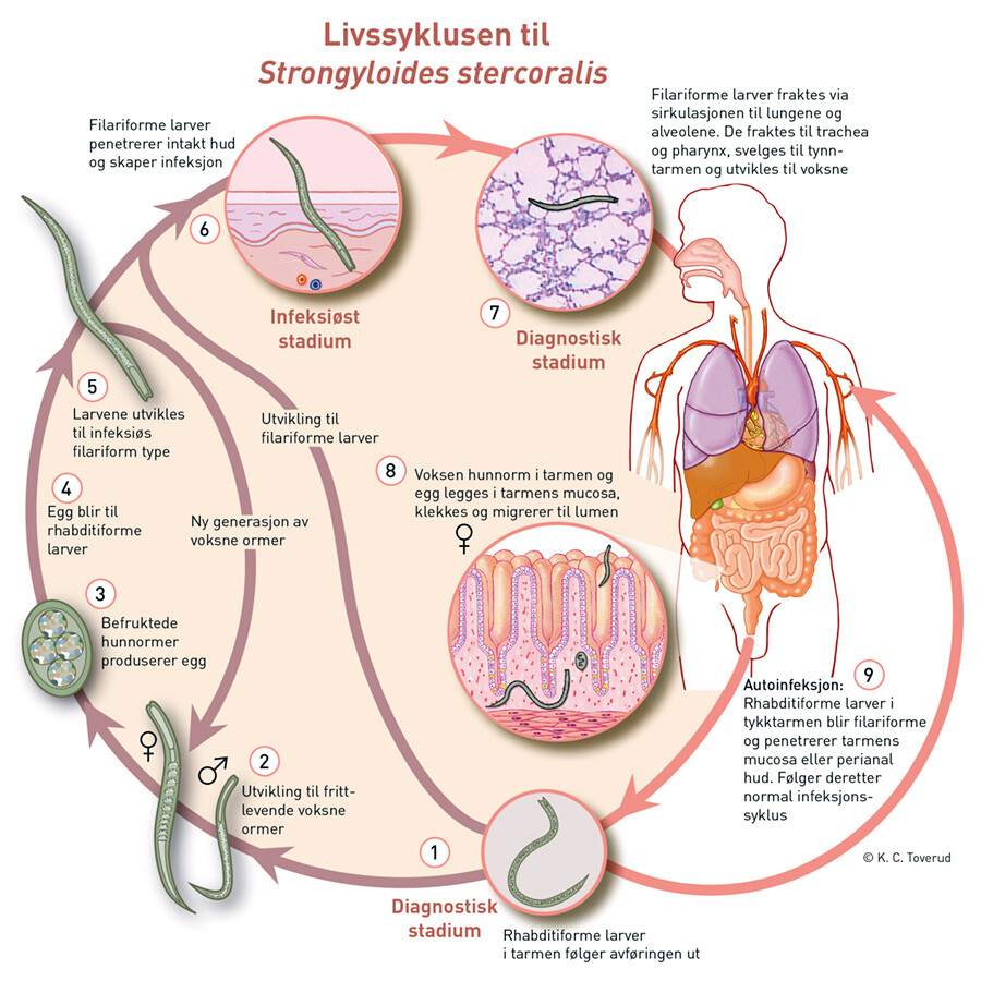 Figur 2 Livssyklusen til parasitten Strongyloides stercoralis. Bearbeidet og gjengitt med tillatelse fra Centers for Disease…