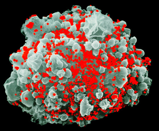 Illustrasjonsfoto: Science Photo Library/NTB scanpix