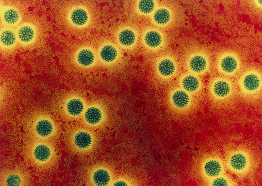 Farget elektronisk mikrofotografi (Coloured transmission electron micrograph, TEM) av rotavirus. Viruset har fått navnet på…