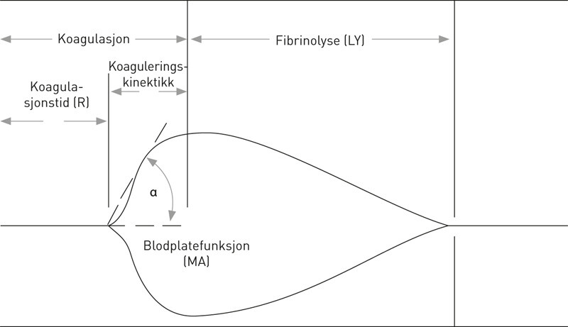 Figur 2  Variablene man skal vurdere i en tromboelastografikurve. Kurven har en dobbeltsidig fasong for å forenkle…