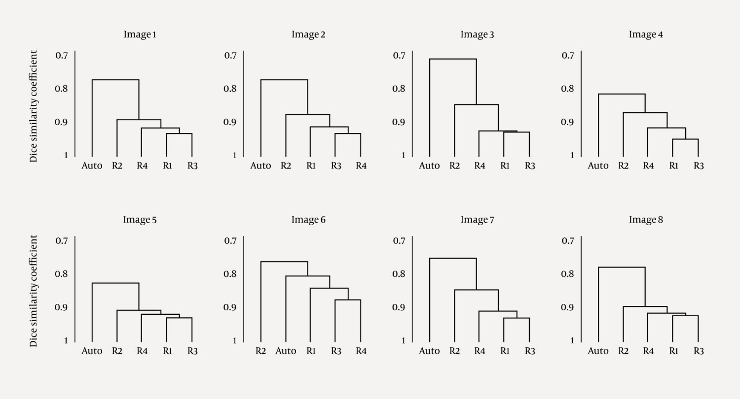 Figure 1 Dendrograms from an agglomerative hierarchical cluster analysis based on data from Røislien and Samset (1). Four…