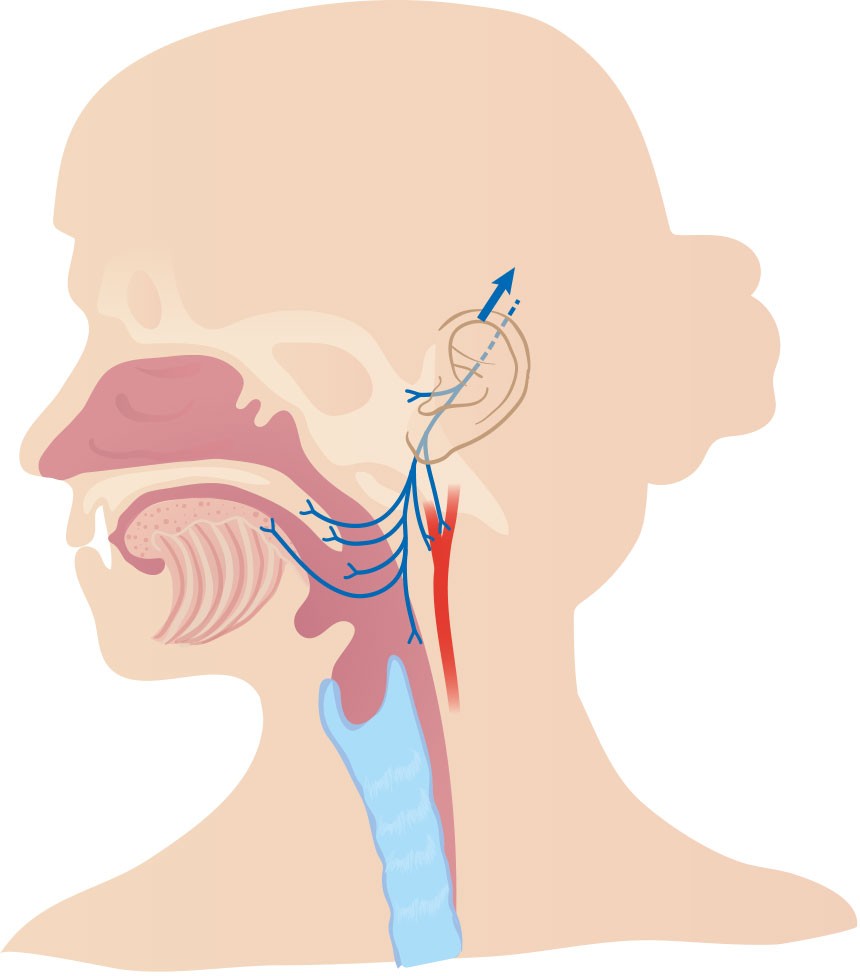 Figure 2 The glossopharyngeal nerve receives sensory fibres from the pharynx, auditory tube, middle ear, posterior part of…