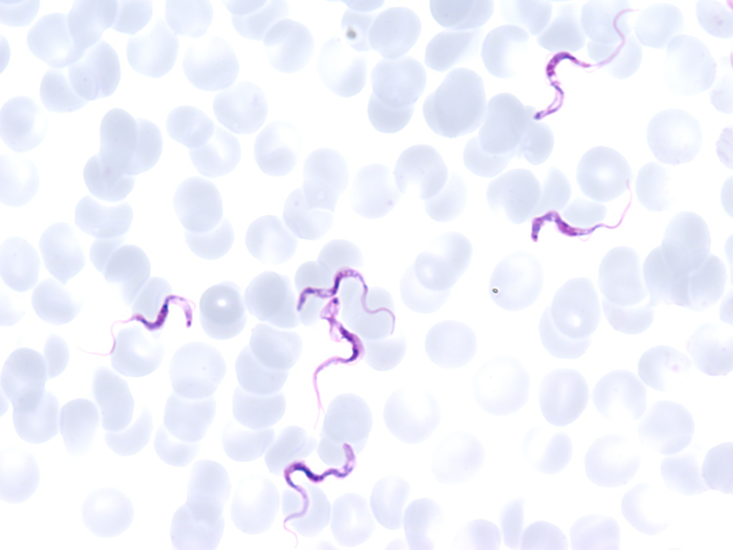 Figur 1 Trypanosoma brucei rhodesiense i blodutstryk. Foto: Bjørn Blomberg