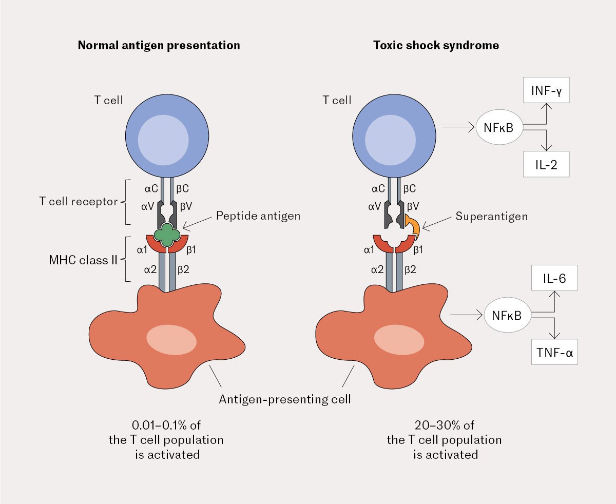 Figure 2 Schematic overview of normal T-cell activation and abnormal T-cell activation induced by a superantigen (reproduced…