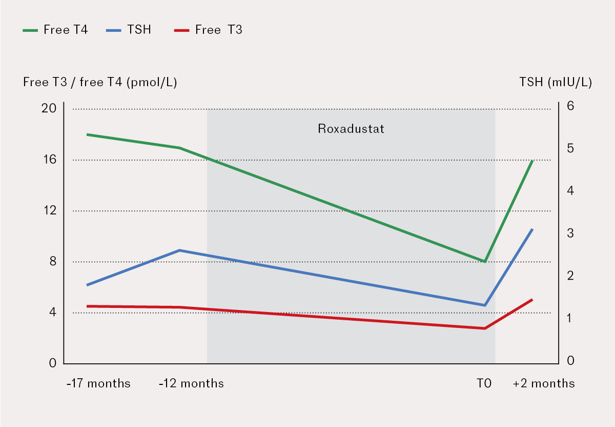 Figure 1 Thyroid function tests before, during and after treatment with roxadustat in a woman in her sixties with chronic…