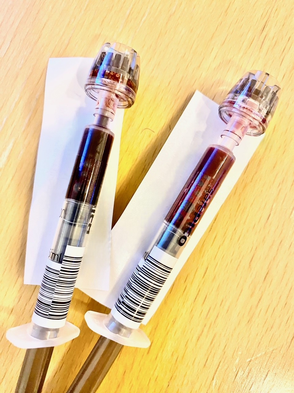 Figure 1 Arterial blood gas sample before (left) and after (right) treatment with methylene blue.