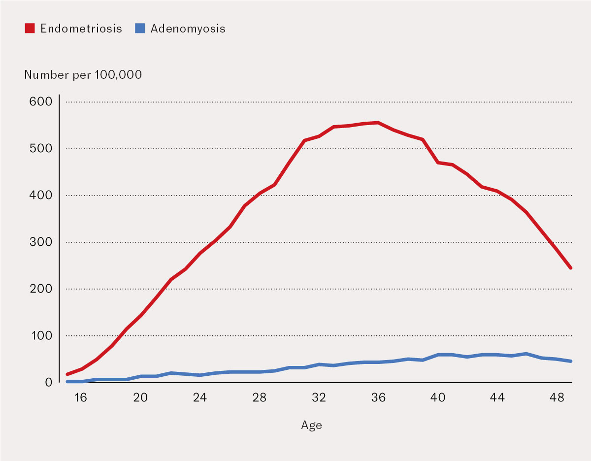 Figure 3 Number of women with endometriosis and adenomyosis per 100,000 women, registered in the specialist health service…