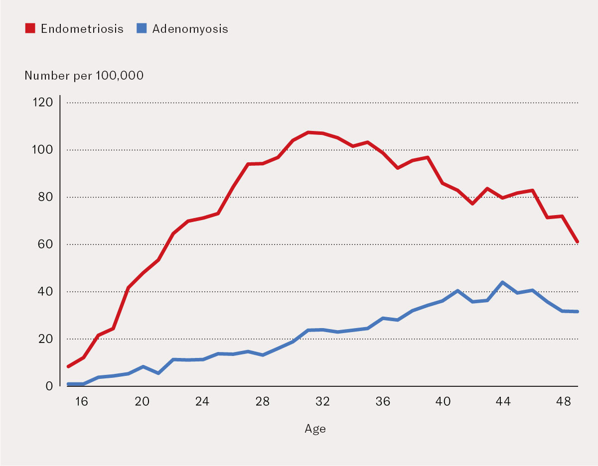 Figure 4 Age at first registration of endometriosis and adenomyosis in the specialist health service, by age group, in the…