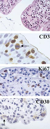 Figur 3   Immunhistokjemiske analyser av celler og vev var forskning for 15 – 20 år siden, men er nå en del av hverdagen i…