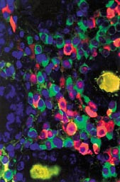 Figur 4   Med forskjellige visualiseringsmetoder, som for eksempel in situ-hybridisering, kan både muterte og normale gener…