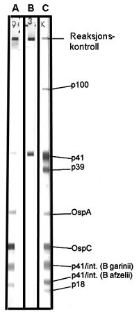 Figur 2   Immunblot som viser IgM-reaktivitet mot rekombinant framstilte antigen frå B burgdorferi. Antigena er immobilisert…